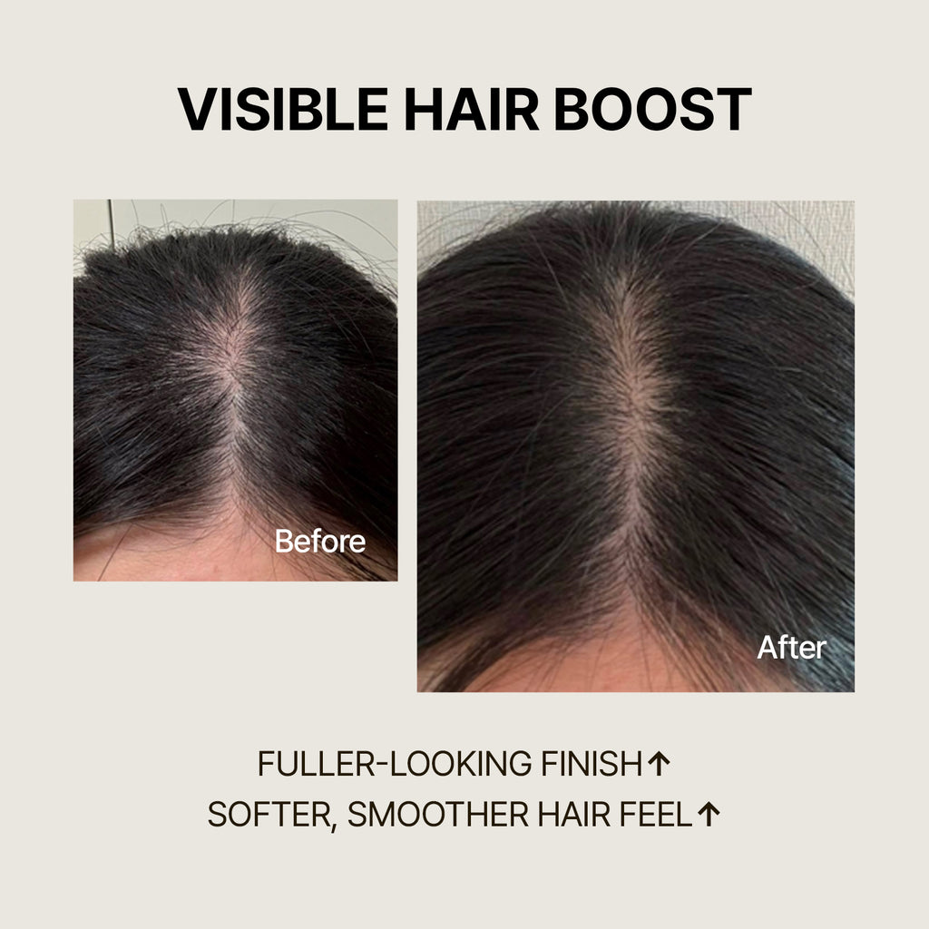 Biotin Shampoo for Hair Loss | SimplyO