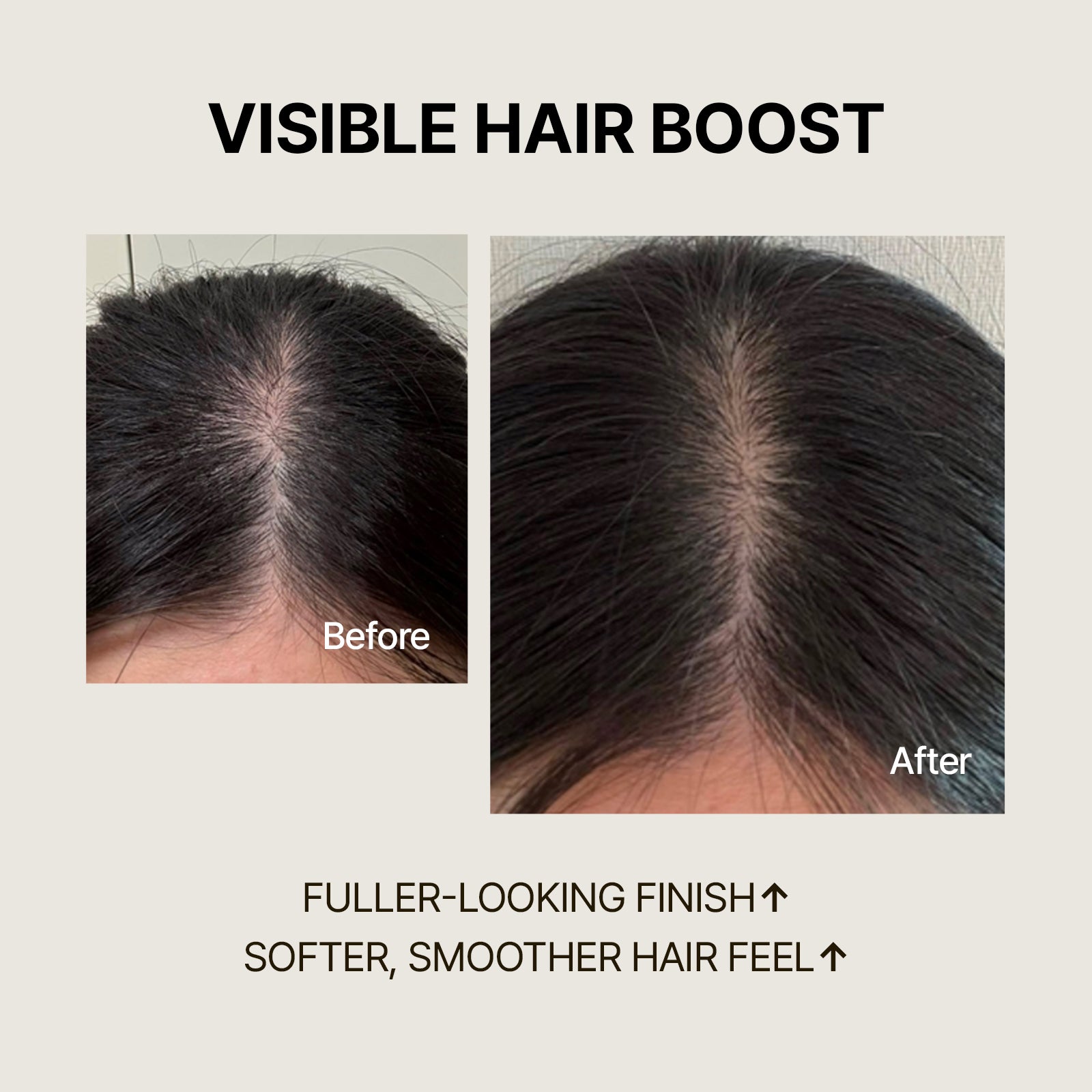Biotin Shampoo for Hair Loss | SimplyO