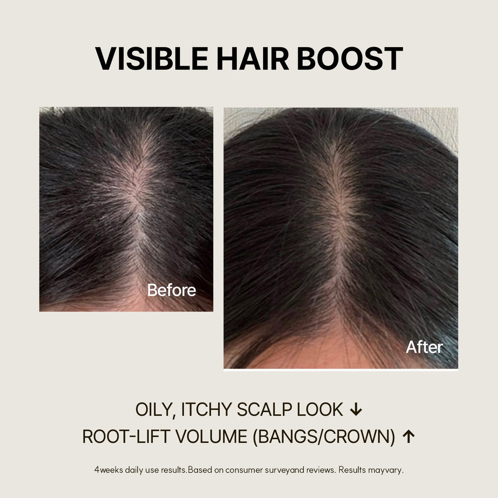 Biotin Scalp Ampoule for Hair Loss | SimplyO
