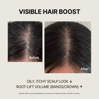 Biotin Scalp Ampoule for Hair Loss | SimplyO