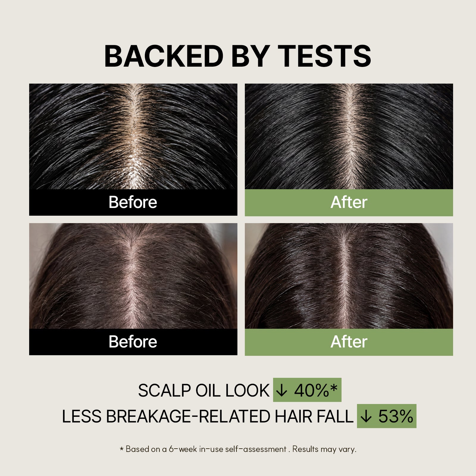 Biotin Ampoule for Hair Loss