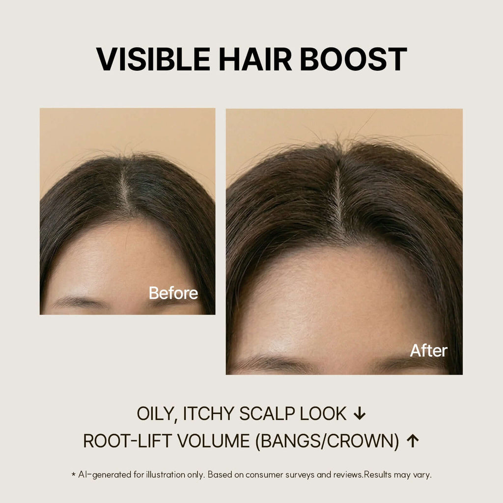 Before and after results using Biotin Scalp Ampoule for Hair Loss showing root volume improvement